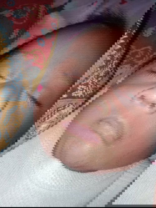 Bun tau gak obat/salep untuk bayi 2 bulan akibat ruam sufor apa ya bun