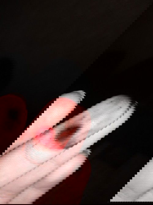 Pagdurogo ng 9weeks normal po ba yan nasa larawan?