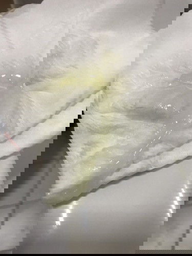 ท้อง39 สัปดาห์ ท้อง2