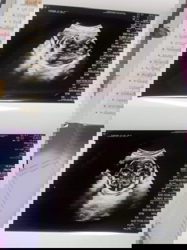 ตั้งชื่อเล่นลูกน้อย