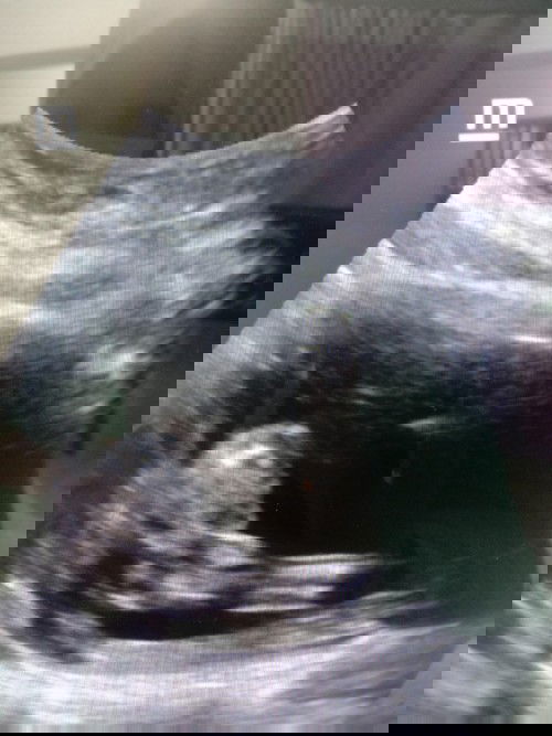 Hai nak tanya ibu dlm ni gambar ni baby girl atau boy boleh kongsi sedikit