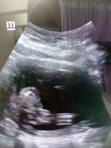Hai nak tanya ibu dlm ni gambar ni baby girl atau boy boleh kongsi sedikit