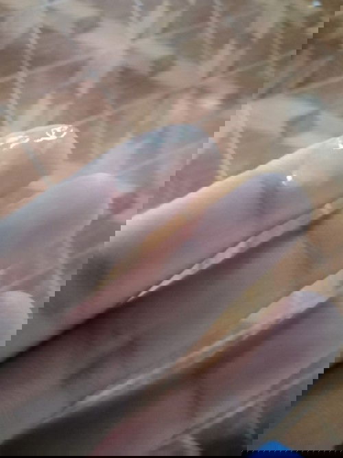 ถ้าเป็นแบบนี้เป็นเพราะอะไรคะ เป็นไม่เยอะ แต่ไหลเป็นบ่อย 39วีคแล้ว แต่ไม่มีมูกเลือด