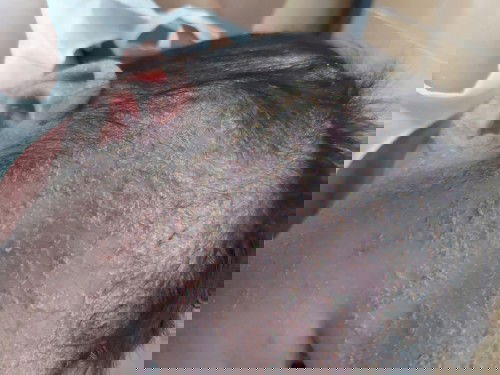 ผิวแห้งมาก