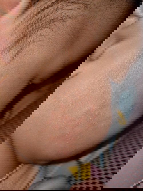 Bintik merah dipipi anak