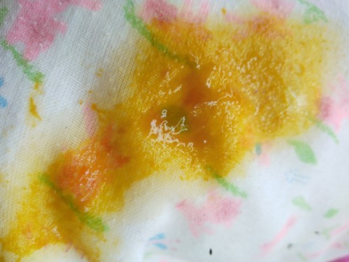 ขอสอบถามแม่ๆค่ะ ลูกถ่ายเป็นมูกใสมีเลือดปน