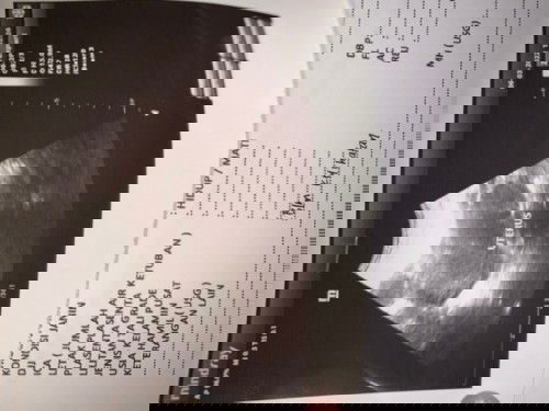 Hasil usg 6w belum keliatan apa2