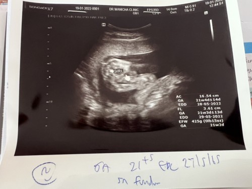 ผญชัวร์ไหมคะแม่ๆ