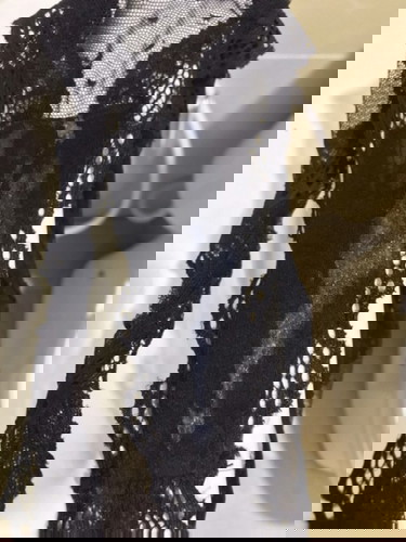 Vagina Discharge
