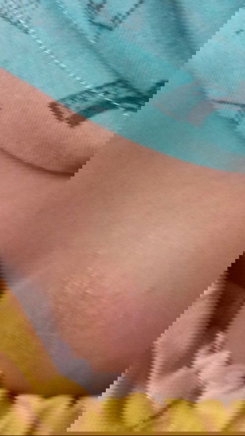 Ini ruam popok ataw jamur ya bunda??