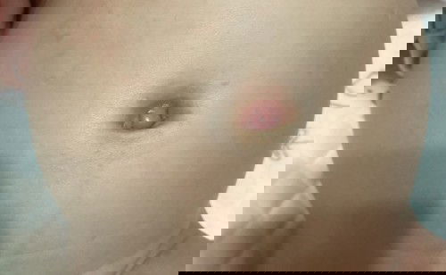 Pusat baby 2 bulan merah?