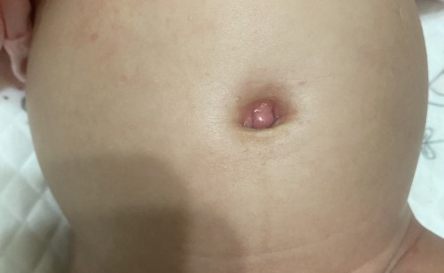 Pusat baby 2 bulan merah?