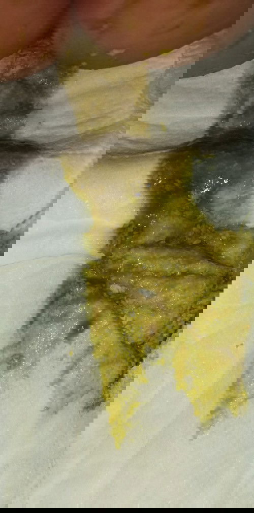 Normal po ba poop ni baby?