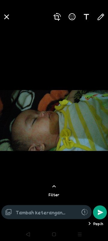 Mau tanya rong mom ,kalo anak campak harus gimana ya:(