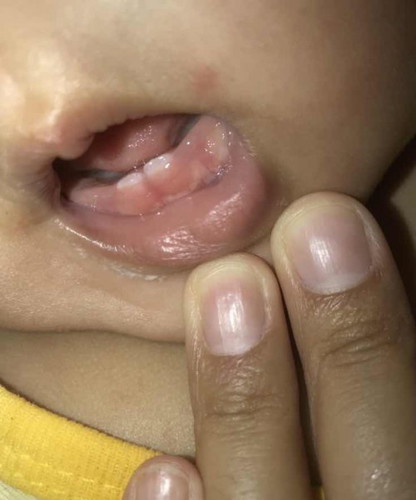 เบบี้บ้านอื่นฟันงอกตอนกี่เดือนคะ