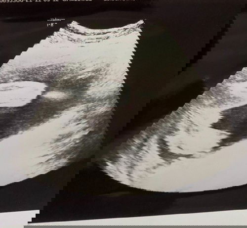 Hpl juni sudah tau jk nya apakah? Yuk sharing.