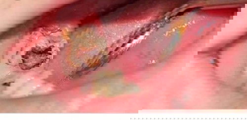 NEED AN ANSWER PO; PUDPOD NA BAGANG SA ITAAS