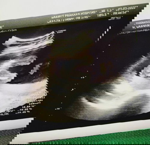 19สัปดาห์3วัน