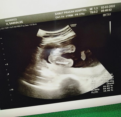 19สัปดาห์3วัน