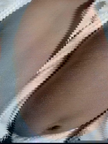 ลูกแพ้ครีมแพ้สบู่