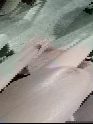 นอนหงายแล้วเจบท้องท้องซ้ายขวา