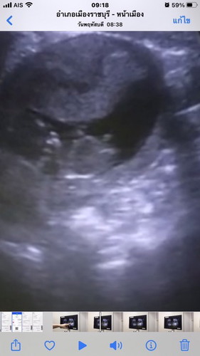 ไม่แพ้ท้อง แต่ชอบนอน