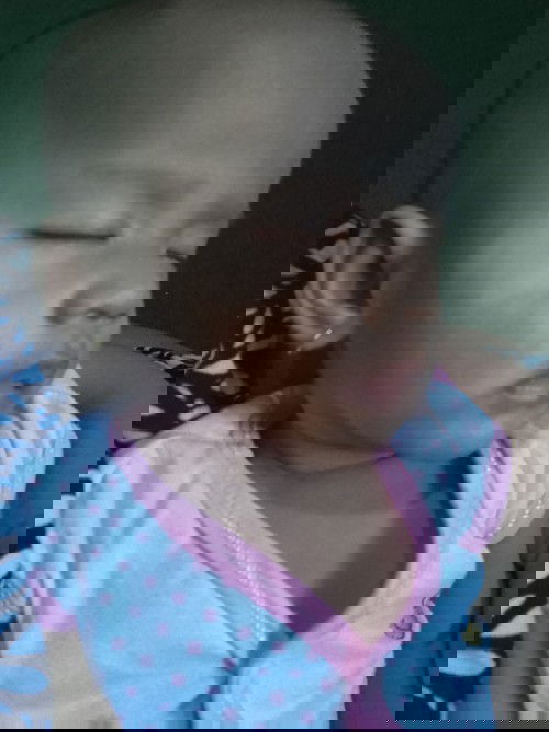 Belang-belang di wajah bayi