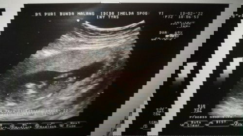 Djj Lemah, dan kuret di usia 14 week