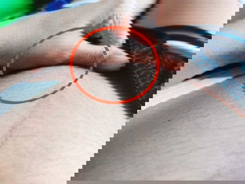 Bumubukol si baby sa puson