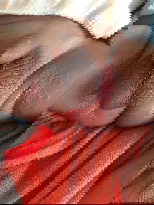 ทาอะไรถึงจะหายค่ะ แนะนำทีค่ะ