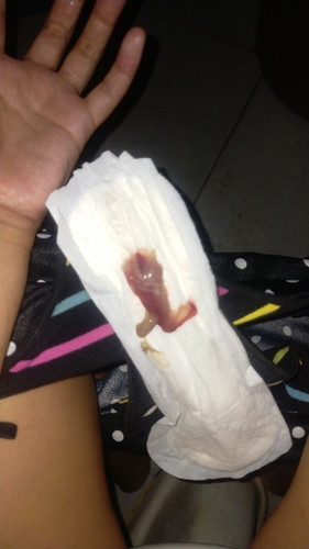 Pasensya na po sa maselang pic