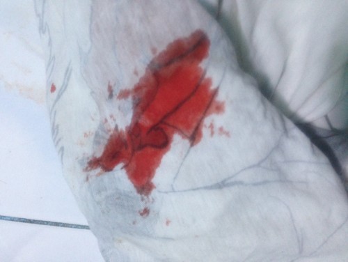 11weeks buntis. First time mommy