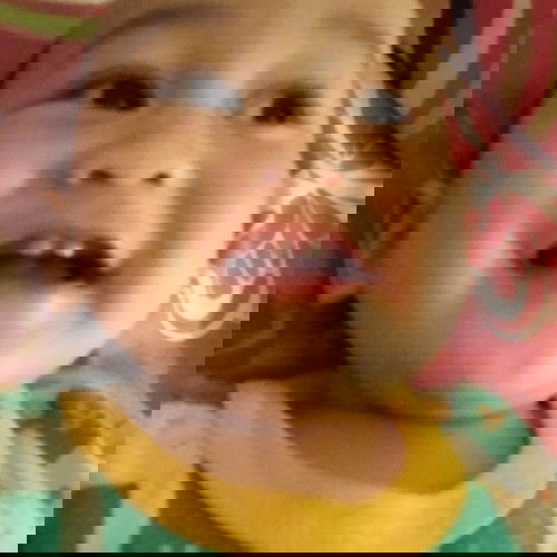 Bagaimana menghadapi GTM karena Tumbuh Gigi?