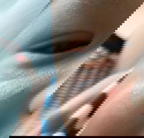 Mga moms pahelp nmn pO, anu kya 2ng nsa mukha ng baby ko dati maliit lng ngyon lumlki n.