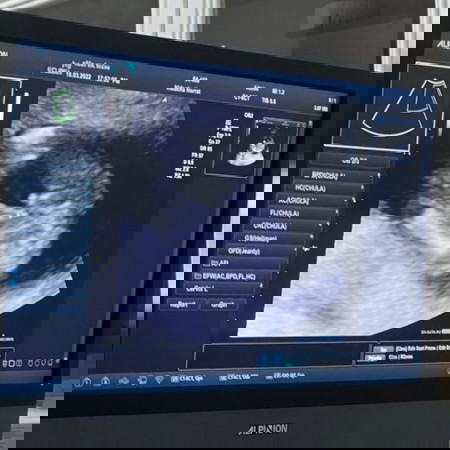 สอบถามแม่ๆค่ะ