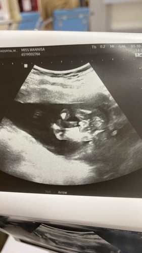 ท้องได้16สัปดาห์5วัน ช่วยดูหน่อยจ้า หญิงหรือชาย