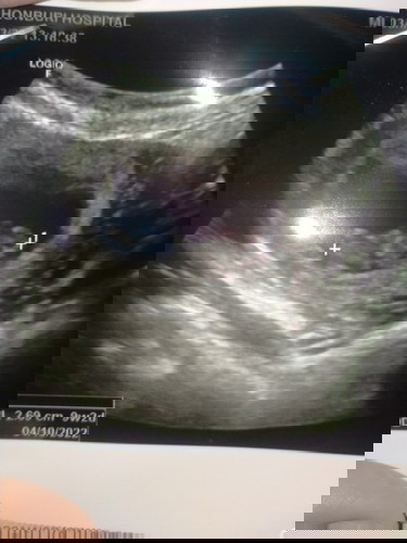 สงสัยมากคะแม่