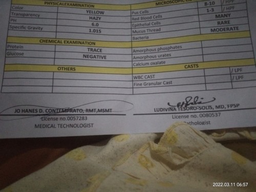 How to read urinary test result