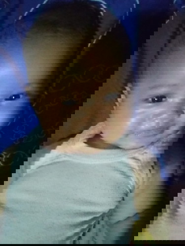 Mata Terlihat Juling