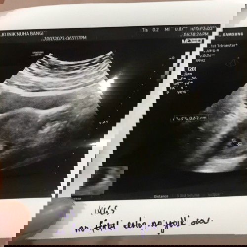 Kantung kosong 6minggu