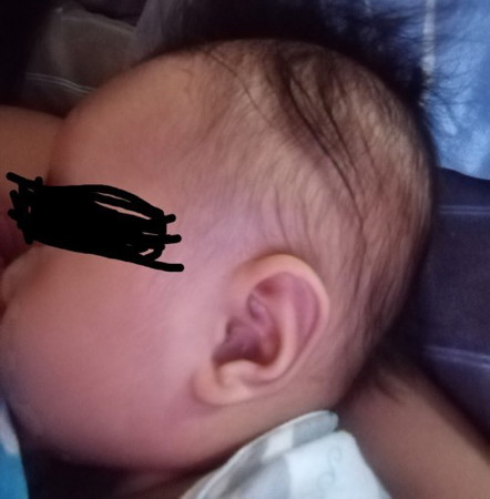 Normal lang po ba ito