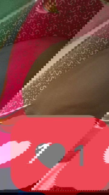 Jidat anak aku kenapa ya bun