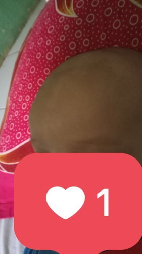 Jidat anak aku kenapa ya bun