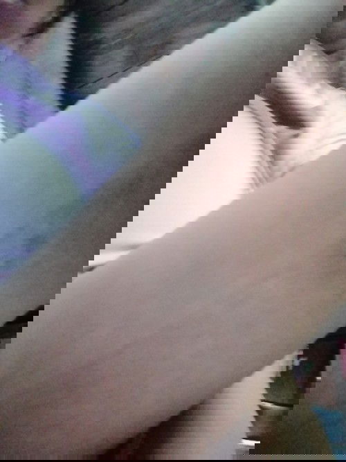 ขาเป็นคลาบดำเหมือนเป็นขี้ไคลแต่ขัดไม่ออกเป็นเหมือนกัน2ข้างเลยคะมีวิธีแก้ไหมจะหายไหม🥺😥