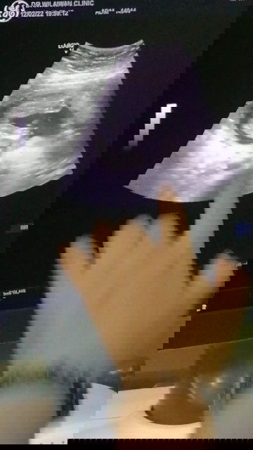 แม่ๆบ้านอื่นคิดว่าน้องเป็นผู้หญิงหรือผู้ชายค่ะ