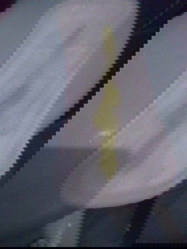 Vaginal discharge