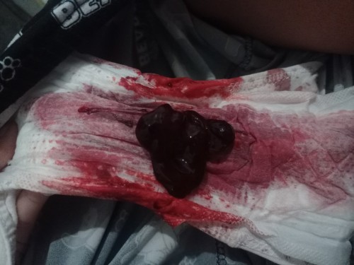 NAKUNAN PO BA AKO 4WEEKS PREGNANT NO TO BASH PO SANA WALA PO AKO PAMPACHECKUP😭