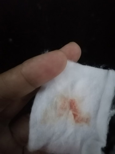 keluar darah segar