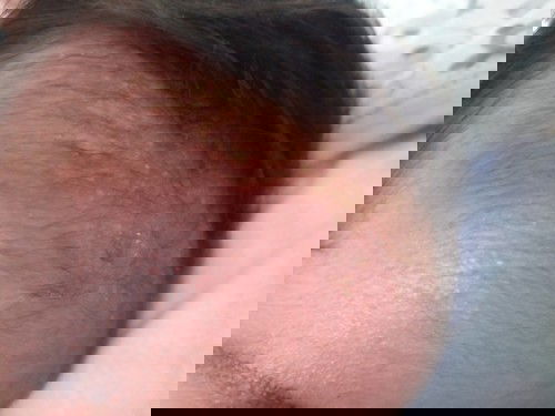 Kerak kepala bayi berbau