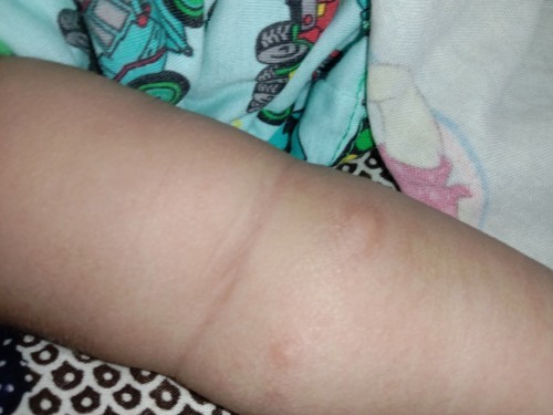 Bingung dan harus bagaimana